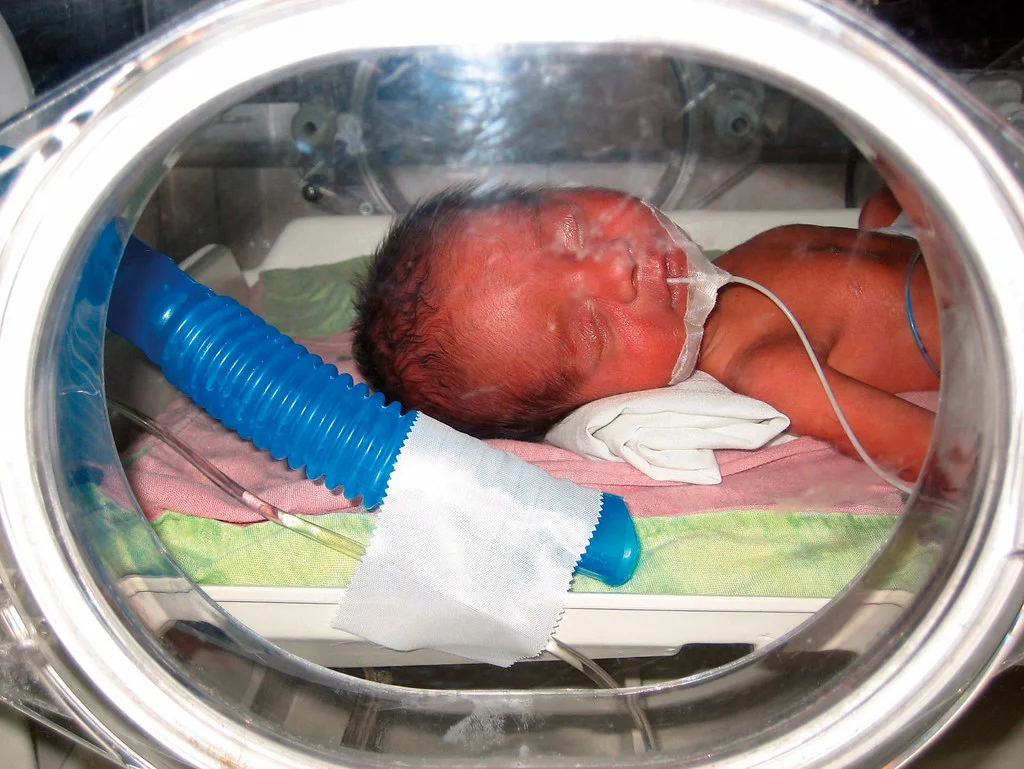 Ce poate cauza nașterea prematură și ce este recomandat să faci în cazul unei astfel de nașteri