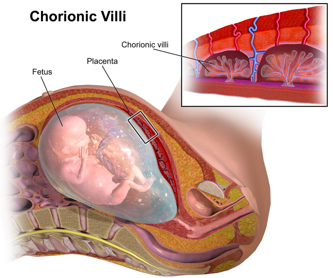 Testul de vilus chorionic în timpul sarcinii - chorionic villus sampling